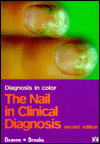 D.W. Beaven & S.E. Brooks: 'A Color Atlas of the Nail in Clinical Diagnosis'.