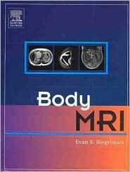 Body MRI by Evan S. Siegelman: Book Cover