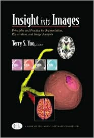Insight into Images by Terry S. Yoo: Book Cover