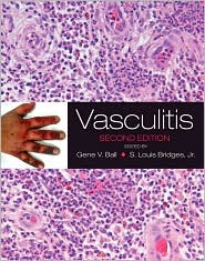 Vasculitis by Gene V. Ball: Book Cover