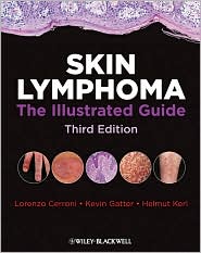 Skin Lymphoma: The Illustrated Guide