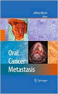 Oral Cancer Metastasis