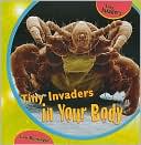 Tiny Invaders in Your Body